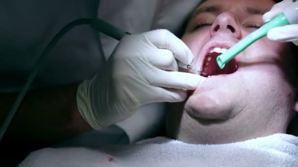 Zahnarzt behandelt seinen Klienten mit den Zahnwerkzeugen - Filmmaterial, Video