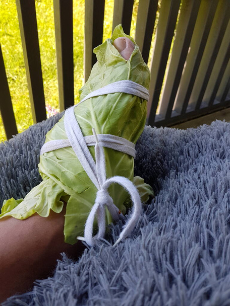 Wrapped  legs with white cabbage leaves.Cabbage Leaves Can Pull Out Diseases From Our Body. Wrapping leg in cabbage for pain relief - Photo, Image