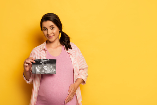 беременная женщина показывает ультразвуковое сканирование при прикосновении к желтому животу   - Фото, изображение