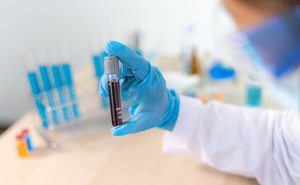Naukowcy testują leki przeciwretrowirusowe z krwi zakażonych pacjentów w celu analizy antybiotyków do normalnego leczenia, Testowanie leków przeciwretrowirusowych lub koncepcji patogenów. - Zdjęcie, obraz