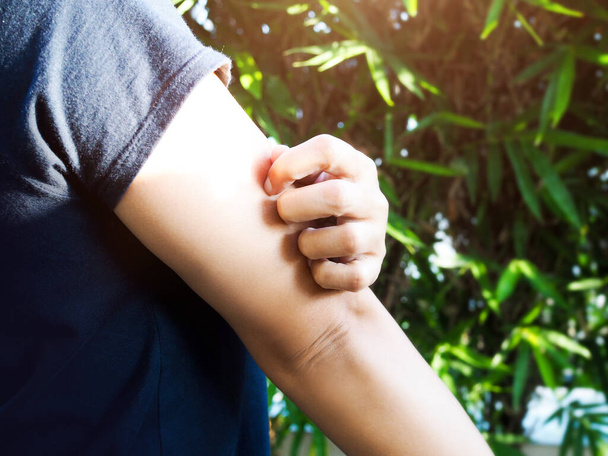 Mladá žena lidé s rukou škrábání na paži z těla kožní onemocnění podrážděné a svědění. - Fotografie, Obrázek