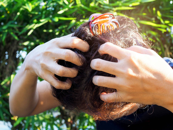 Mulher asiática com cabelo preto com coceira e arranhões na cabeça
. - Foto, Imagem