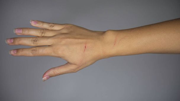 Een vrouw de hand gekrabd door een kat op een grijze achtergrond. - Foto, afbeelding
