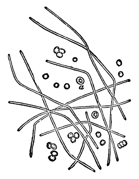 The rodlets after three hours' culture in a drop of aqueous humour. They grow out into long leptothrix-like filaments, which become septate later, and spores are developed in the segment, vintage line drawing or engraving illustration. - Vector, Image