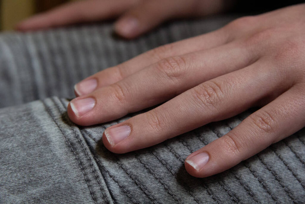 Fingers, not trimmed nails. - Fotoğraf, Görsel