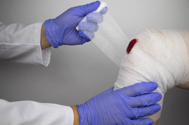 Der Arzt bandagiert das Knie eines verletzten Mädchens. Stoppen Sie die Blutung, indem Sie einen Druckverband auf die Verletzung legen. Erste Hilfe bei Verletzungen. Die Technik des Auftragens einer Kreuzbandage. - Foto, Bild