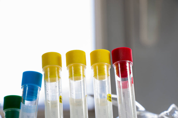 Лабораторні зразки аналізів крові, дослідницькі діагностики, інструменти та об'єкти у стерильній таблиці Студійна стрілянина
. - Фото, зображення