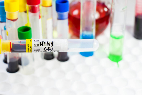 H1N1-Schweinegrippe, Diagnosen und Labortests, Blutproben, Text und Brief. Studio-Shooting auf weißem Hintergrund. - Foto, Bild