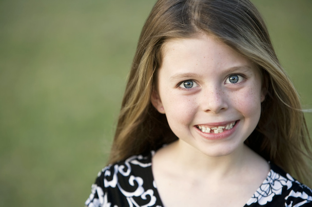 Pretty Young Girl with Crooked Teeth - Zdjęcie, obraz