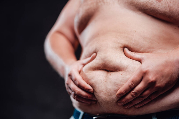Very fat man shows off his huge belly - Fotoğraf, Görsel