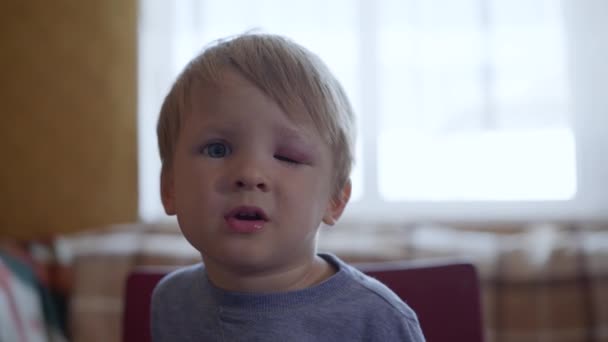 πορτρέτο του θλιμμένου μικρού αγοριού δεν μπορεί να ανοίξει τα μάτια του από έναν τραυματισμό ή μια μελανιά στο πρόσωπό του μισοκρεμασμένη κατά τη διάρκεια επικίνδυνων δραστηριοτήτων για τα παιδιά - Πλάνα, βίντεο