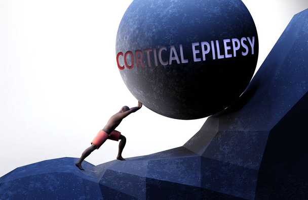 Kortikale Epilepsie als Problem, das das Leben erschwert - symbolisiert durch eine Person, die mit dem Wort Kortikale Epilepsie Gewicht zulegt, um zu zeigen, dass es eine Belastung sein kann, 3D-Illustration - Foto, Bild
