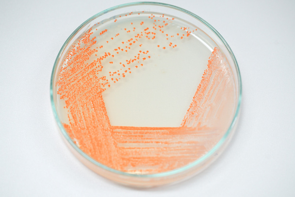 Baktériumkolónia tenyésztőközegben, mikrobiológia. - Fotó, kép