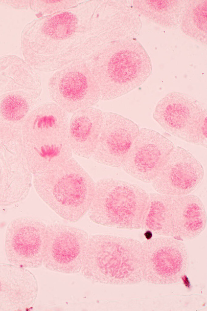 Korzeń końcówki cebuli i komórek mitozy w korzeniowej końcówce cebuli pod mikroskopem. - Zdjęcie, obraz