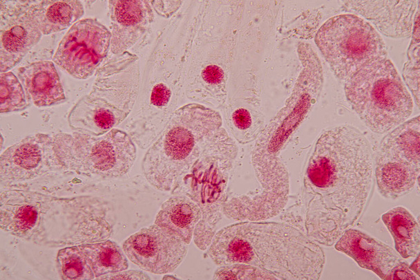 Корінь кінчика цибулі та мітозу в кінчику кореня цибулі під мікроскопом
. - Фото, зображення