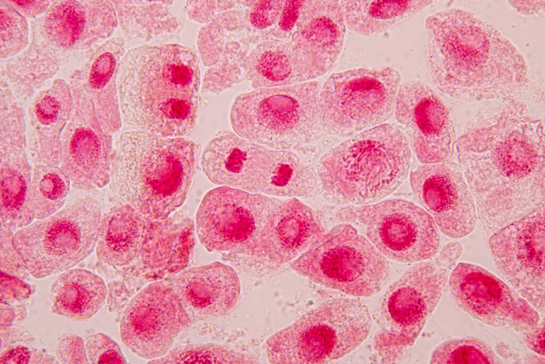 顕微鏡下のタマネギの根先にあるタマネギとミトシス細胞の根先. - 写真・画像
