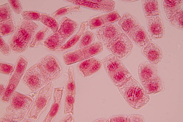 L'extrémité racinaire de l'oignon et la cellule de mitose dans l'extrémité racinaire de l'oignon sous un microscope. - Photo, image