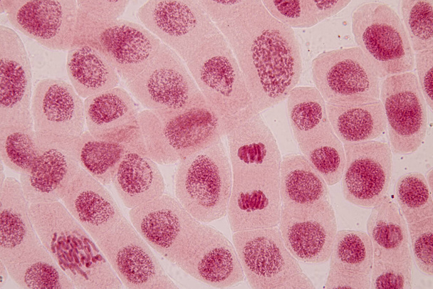 L'extrémité racinaire de l'oignon et la cellule de mitose dans l'extrémité racinaire de l'oignon sous un microscope. - Photo, image