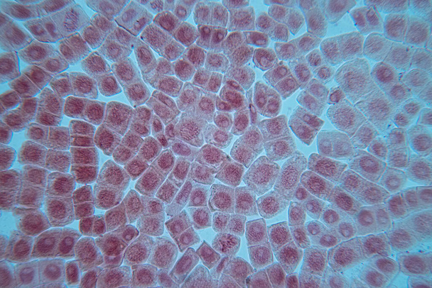 A hagyma és a mitózis sejt gyökércsúcsa a hagyma gyökércsúcsán mikroszkóp alatt. - Fotó, kép