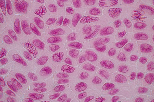 Punta della radice della cipolla e della mitosi nella punta della radice della cipolla al microscopio. - Foto, immagini