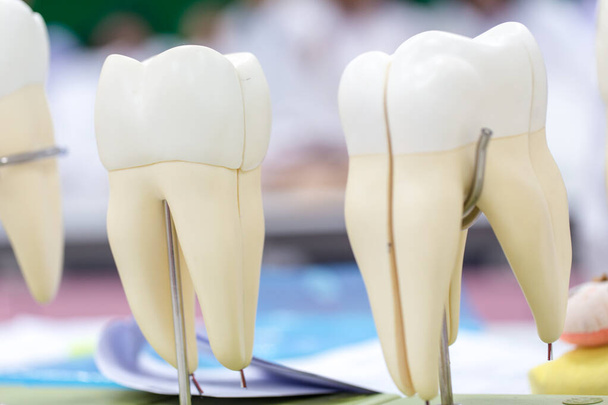 Modèle de dent pour l'enseignement en classe et en laboratoire. - Photo, image