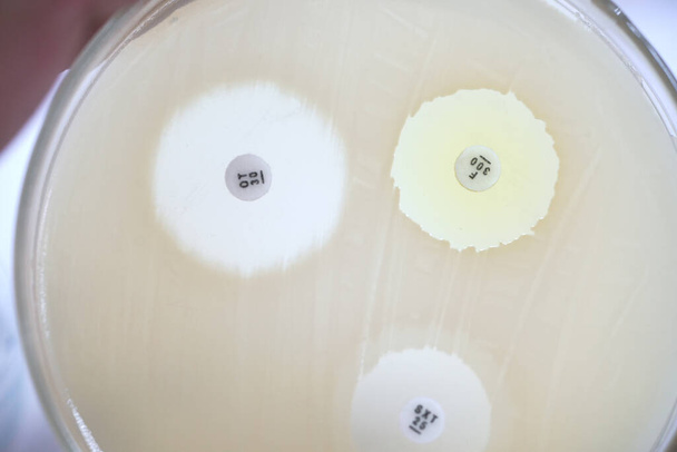 La sensibilità antibiotica dei batteri mediante test di diffusione è un test. Microbiolog - Foto, immagini