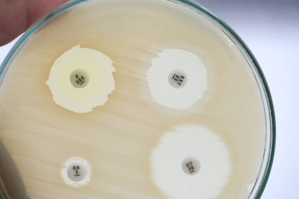 A baktériumok diffúziós vizsgálattal történő antibiotikum-érzékenysége vizsgálat. Mikrobiológia - Fotó, kép