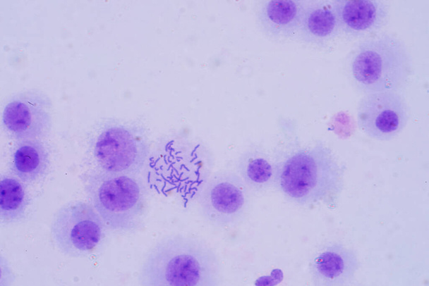 Хромосомы человека под микроскопом для образования - Фото, изображение