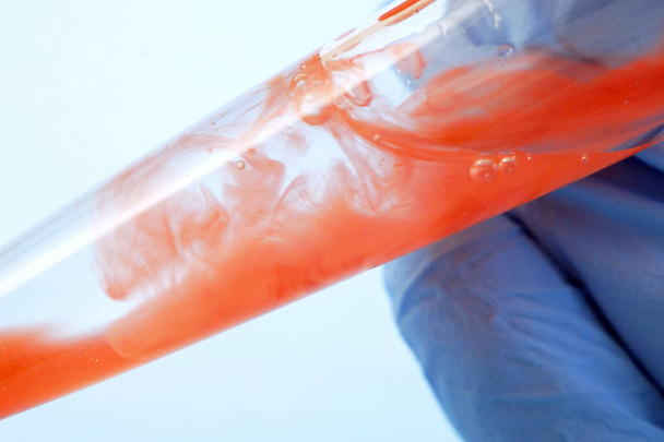 tubos de ensaio com amostra de sangue em laboratório, fecho
 - Foto, Imagem