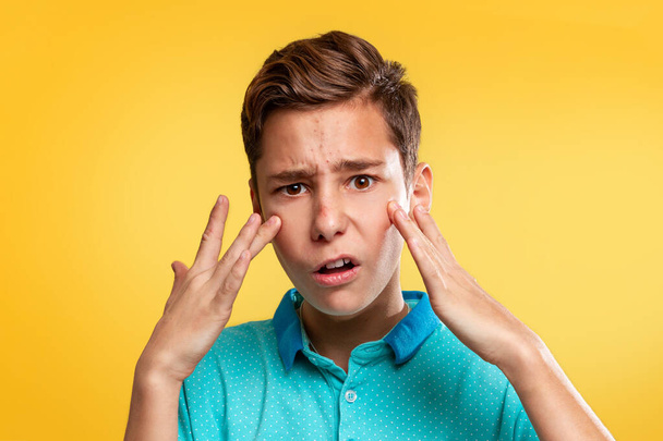 Cosmetology, Dermatology and acne. A Caucasian teenager in a blue t-shirt is upset about the appearance of acne. Yellow background. Copy space. - Фото, изображение