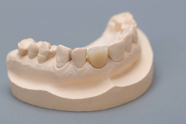 primo piano della manipolazione di un pronto per l'uso a poppa dentizione artificiale - Foto, immagini