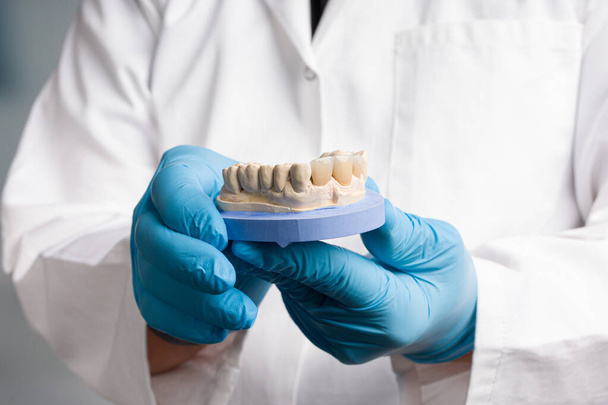 Dentista / técnico dental de la mano en guantes están presentando un  - Foto, Imagen