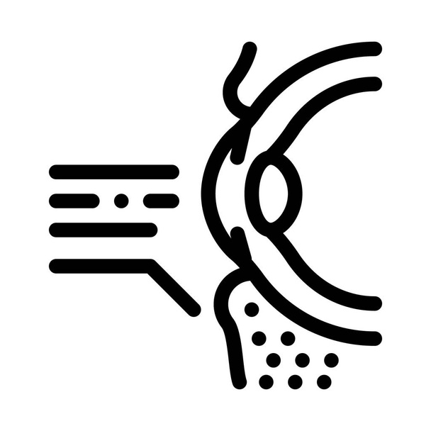 vettore icona correzione della palpebra chirurgia. segno di correzione della palpebra. illustrazione simbolo contorno isolato - Vettoriali, immagini