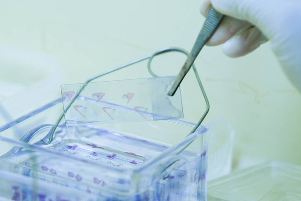 Мікроскопічна ковзаюча біопсія фарбування тканин для діагностики в патологічній лабораторії. Фарбування це допоміжна техніка, яка використовується в мікроскопії для посилення контрасту в мікроскопічному зображенні
. - Фото, зображення