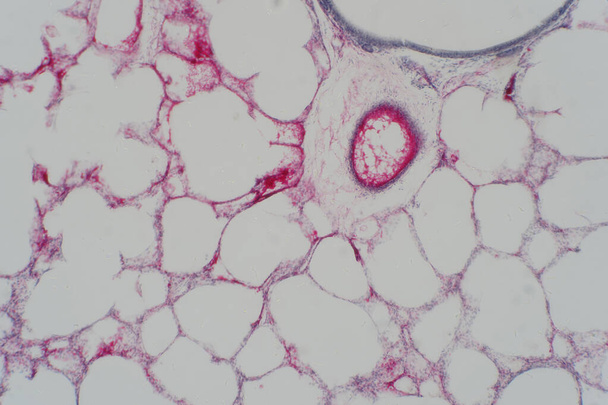 Menschliches Lungengewebe unter dem Mikroskop. Lungen sind die primären Organe der Atemwege bei Menschen und vielen anderen Tieren - Foto, Bild