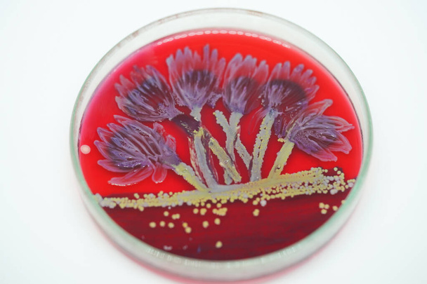 Arte de Colonia de bacterias en medio de cultivo, Microbiología. - Foto, imagen