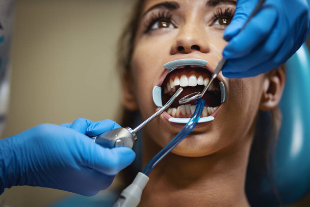 Kaunis nuori nainen on hammaslääkärissä. Hän istuu hammaslääkärin tuolissa ja hammaslääkäri laittaa hammasraudat hampaisiinsa laittaen esteettisiä kielilukkoja.. - Valokuva, kuva