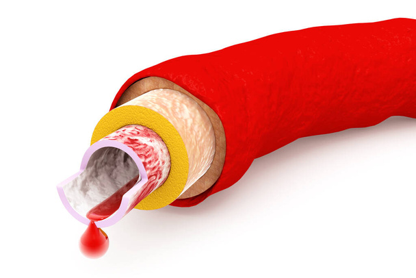 Anatomy of an artery with blood cells. 3d render - 写真・画像