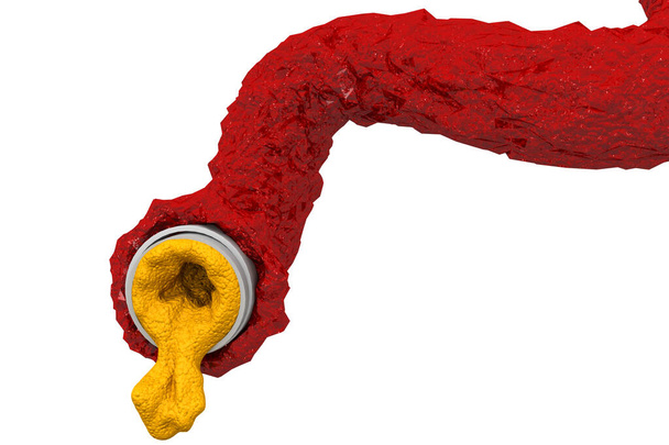 Artéria bloqueada com cholesterol.3d render
 - Foto, Imagem