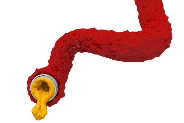 Arteria bloqueada con el render cholesterol.3d - Foto, Imagen