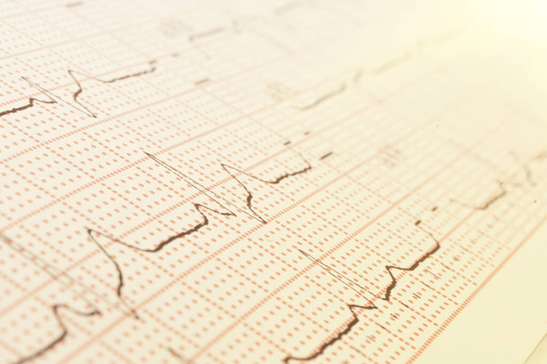 Cardiogram on a sheet of paper close-up. Texture of pulsed waves. - Photo, Image