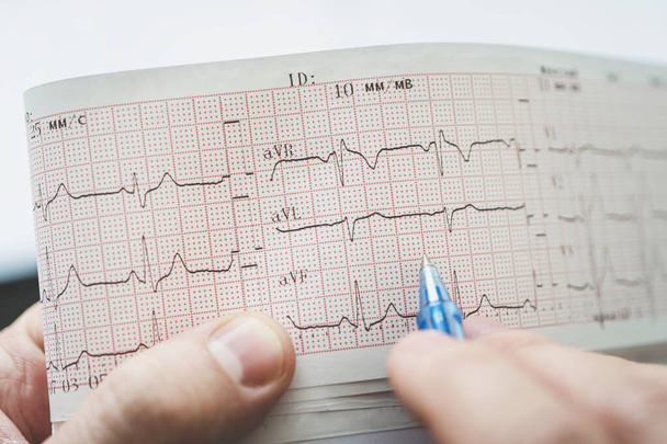 Elettrocardiogramma nelle mani del medico. controllo dello stato di salute cardiaco. - Foto, immagini