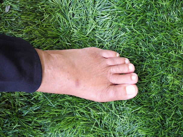 Infiammazione e mal di piedi di anziani asiatici, feriti con dolore ai piedi della malattia - Foto, immagini