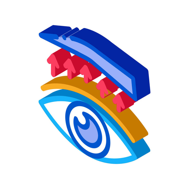 szemhéj műtét kezelés ikon vektor. izometrikus szemhéj műtét kezelés jele. színes elszigetelt szimbólum illusztráció - Vektor, kép