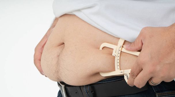Primer plano de las manos del hombre gordo que miden el vientre con sobrepeso mediante el uso de pinza de grasa corporal - Foto, Imagen
