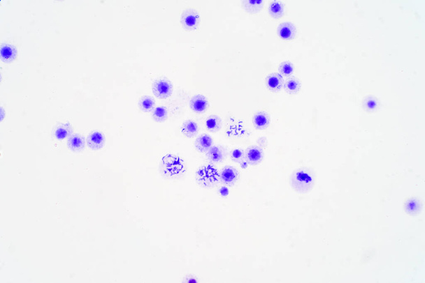 Cromossomas humanos sob visão microscópica para a educação
 - Foto, Imagem