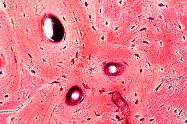 Ιστολογία ανθρώπινου συμπαγούς οστικού ιστού με μικροσκόπιο για εκπαίδευση, σύνδεση μυϊκών οστών και συνδετικό ιστό - Φωτογραφία, εικόνα