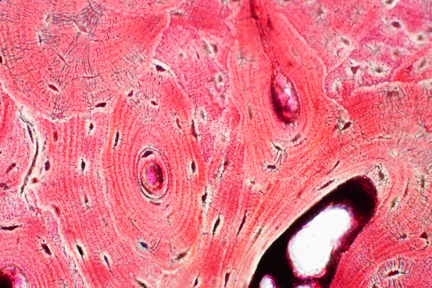 Histologie lidské kompaktní kostní tkáně pod mikroskopem pro výuku, spojení svalové a pojivové tkáně - Fotografie, Obrázek