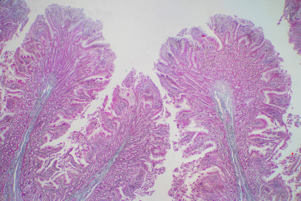 Tessuto intestinale crasso umano al microscopio. Istologico per la fisiologia umana. - Foto, immagini