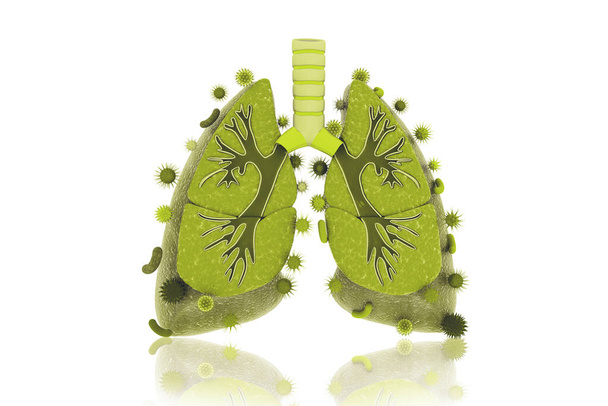 Wirus i bakterie zainfekowały ludzkie płuca. choroby płuc.3d renderowania - Zdjęcie, obraz